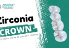 Dental Zirconia Cap: A New Era for Your Long Lasting Smile