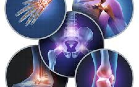 Best Medications for Osteoarthritis Pain Relief: A Guide for Everyday Sufferers