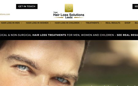 Best Hair Transplants Yorkshire Clinic – Where Confidence is Restored