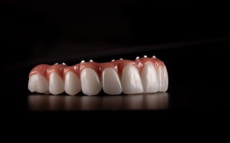 Why Local Experts are the Key to Healthy Smiles in Poole